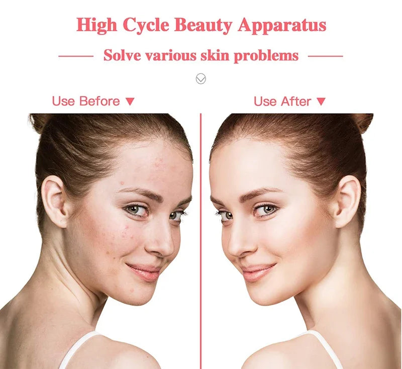 Portable High Frequency Facial Machine Wand Handheld Electric Face Skin Beauty Tools Acne Treatment Device