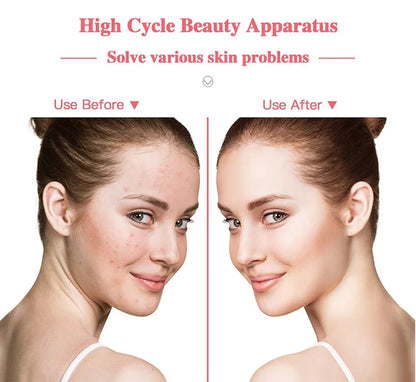 Portable High Frequency Facial Machine Wand Handheld Electric Face Skin Beauty Tools Acne Treatment Device